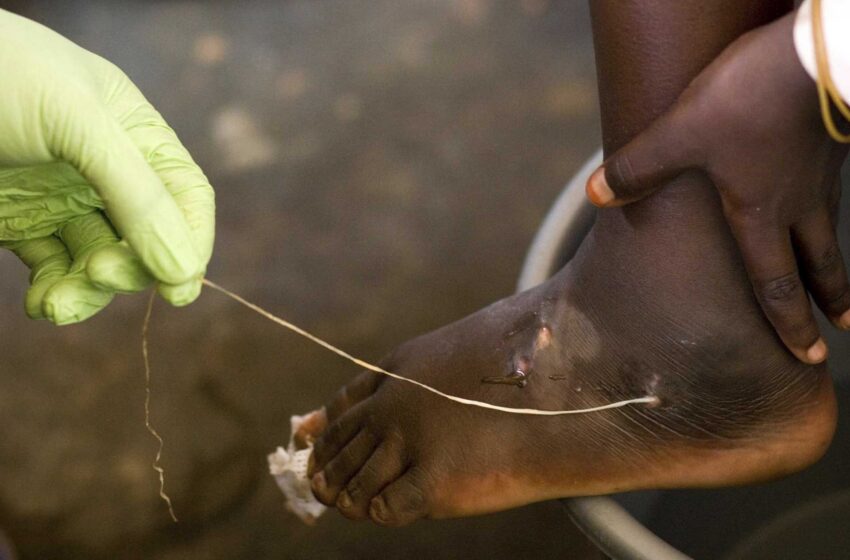  El sueño de Carter, casi alcanzado: Los casos de gusanos de Guinea descienden a 14