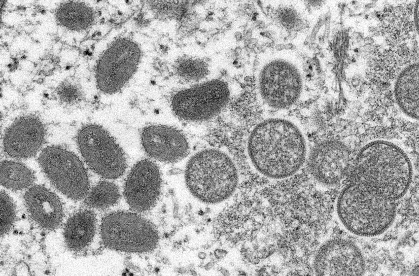  2 cepas de viruela del mono en EEUU sugieren una posible propagación no detectada